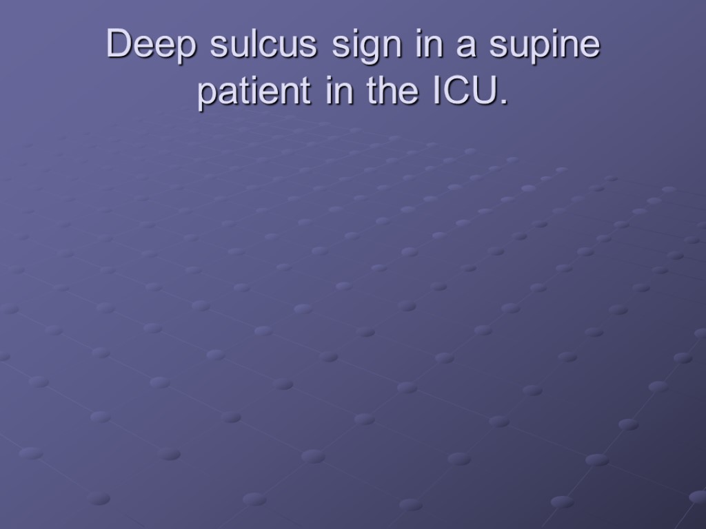 Deep sulcus sign in a supine patient in the ICU.